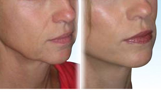 Cosmetic Surgery Cosmetic Surgery